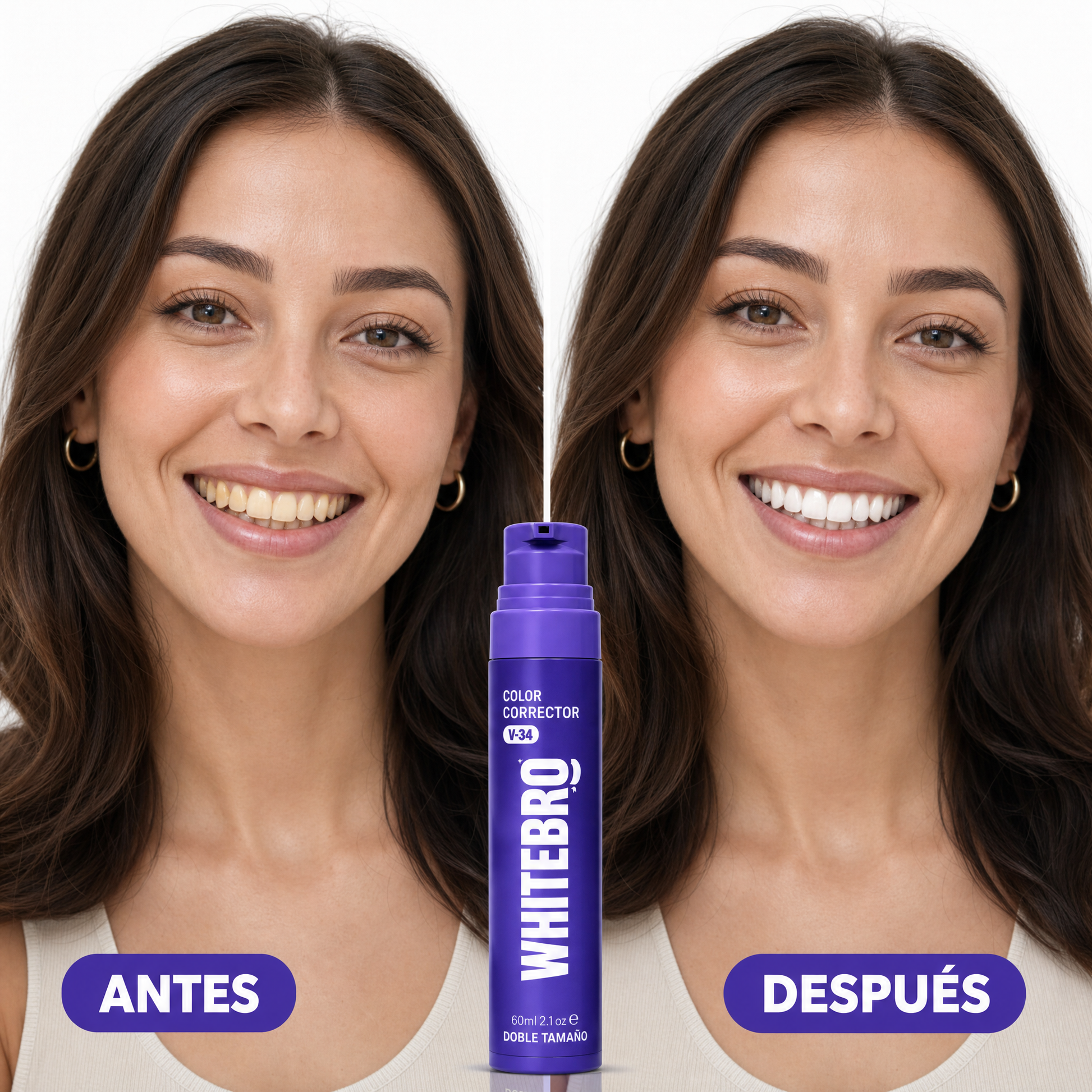 Antes / Después