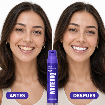Antes / Después
