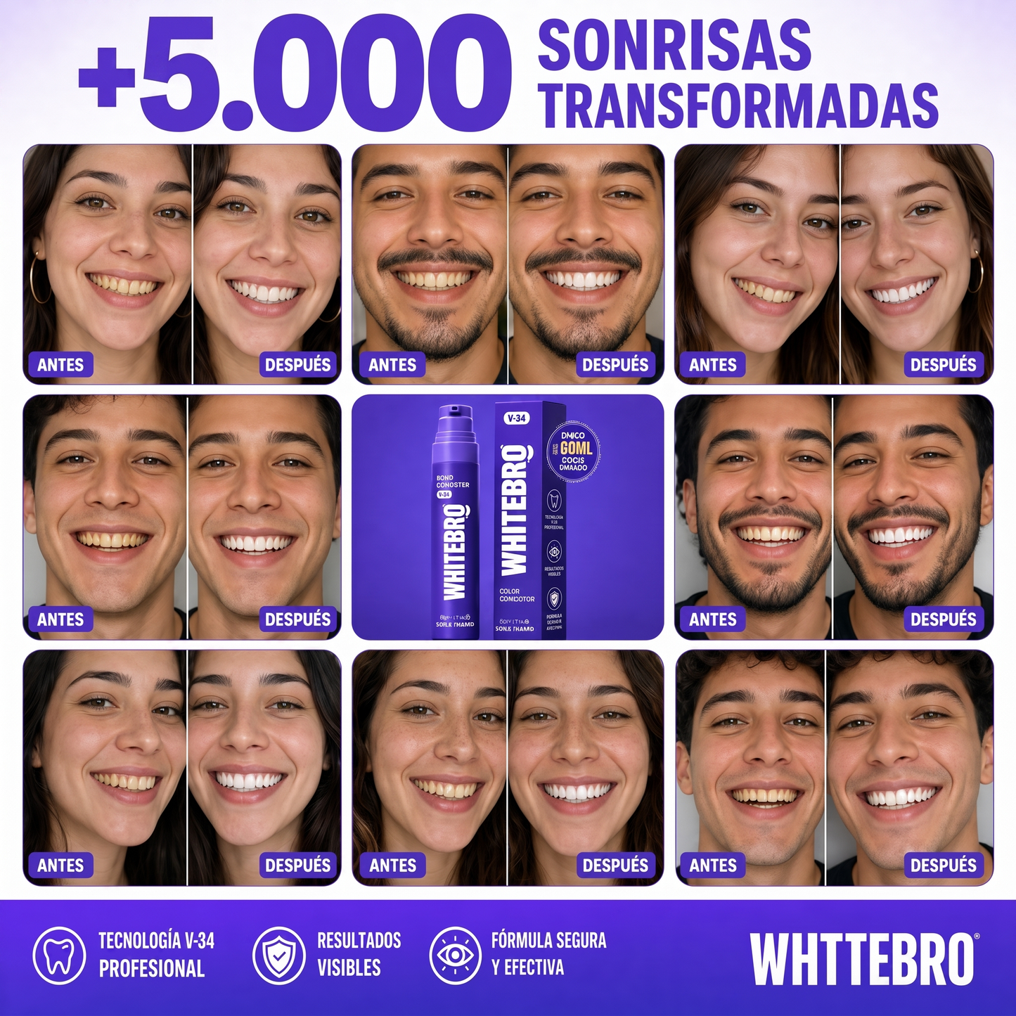 WHITEBRO Color Corrector V-34 — Blanqueador Dental Instantáneo 60ml