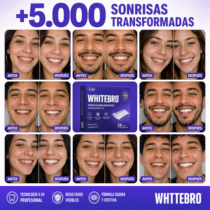+5000 sonrisas transformadas WHITEBRO Tiras
